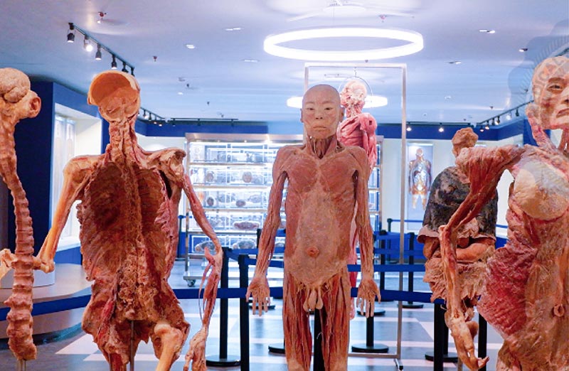 Plastinated Models